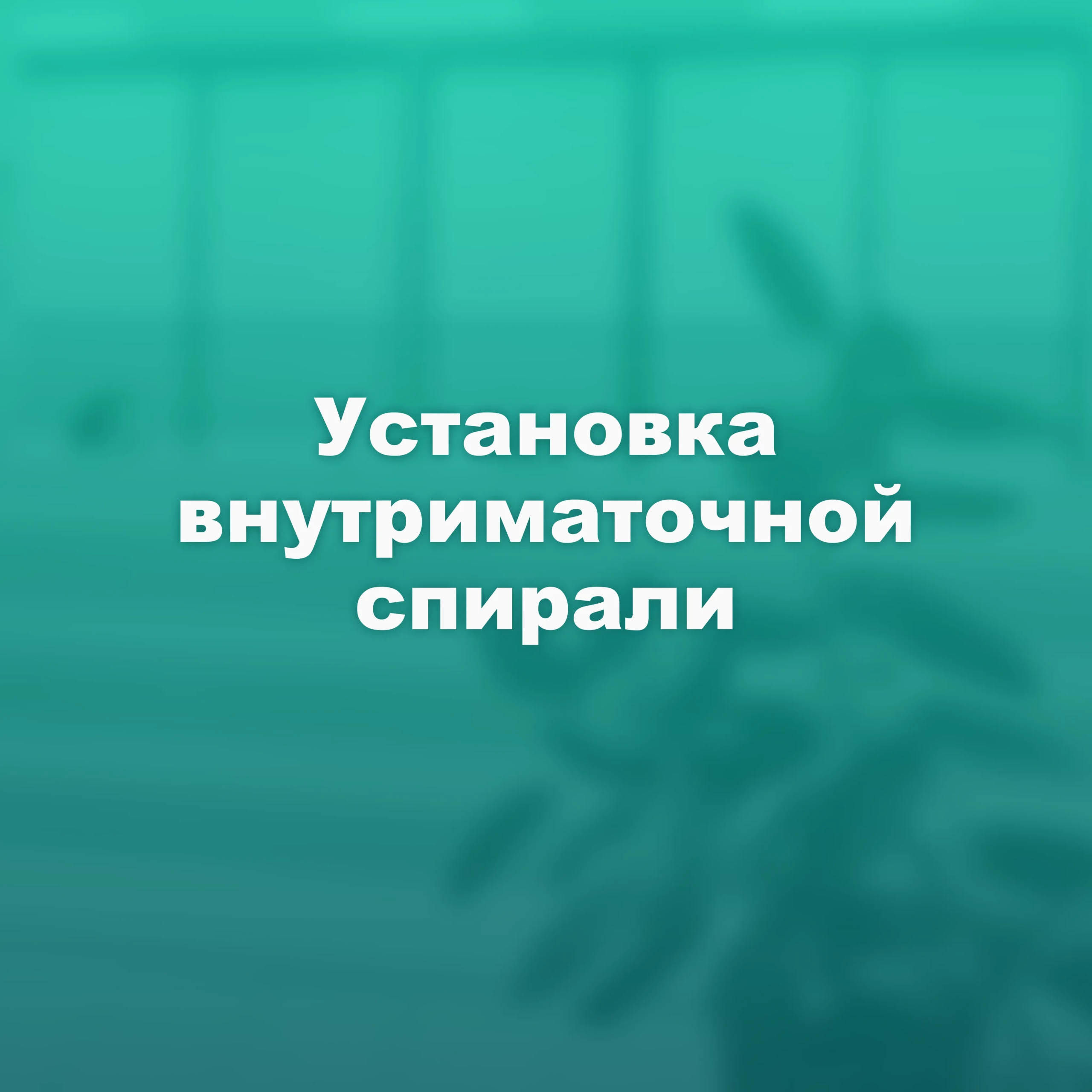 Установка внутриматочной спирали: надежная защита и спокойствие на годы